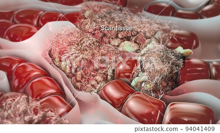Liver cells become infected with virus Liver cells become infected with virus 94041409