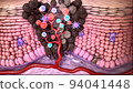 Antibodies destroy an infected cell by a virus, immun defense kill the infected cell 94041448