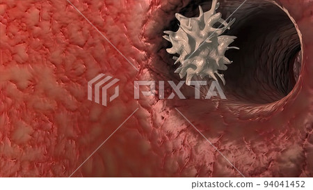 Antibodies destroy an infected cell by a virus, immun defense kill the infected cell 94041452