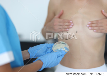 Doctor draws marks on female breast before cosmetic surgery operation and holds silicone implant Doctor draws marks on female breast before cosmetic surgery operation and holds silicone implant 94072615