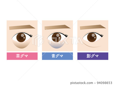 黑眼圈的美容類型 94098653