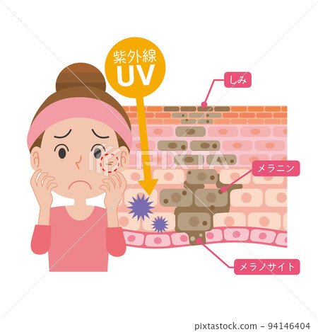 患有皮膚瑕疵的女人 94146404