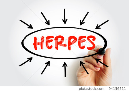 Herpes text with arrows, medical concept for presentations and reports 94156511