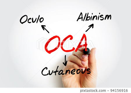 OCA - Oculo Cutaneous Albinism acronym, concept background 94156916