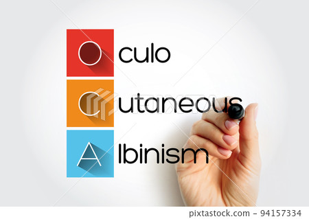 OCA - Oculo Cutaneous Albinism acronym, concept background 94157334
