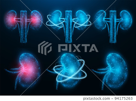 Set of polygonal vector illustrations of inflamed diseased kidney, healthy kidney, and recovery of kidney functions. Internal organ low poly design. Urology or nephrology medical banner, template. 94175263
