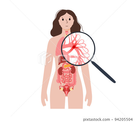 Pulmonary embolism disease 94205504