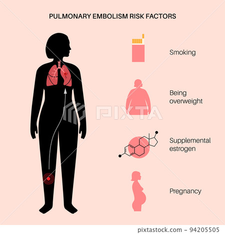 Pulmonary embolism disease 94205505