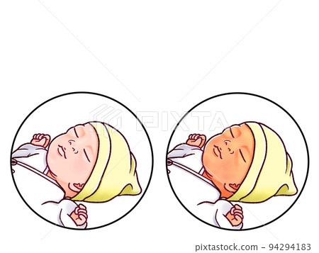 Illustrated illustration of newborn jaundice (pathological jaundice) and normal comparison Illustrated illustration of newborn jaundice (pathological jaundice) and normal comparison 94294183