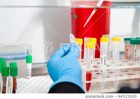 Scientist preparing blood samples for karyotipe and fluorescence in situ hybridization in the  laminar air flow cabinet. Blood sample preparation for diagnosis. Blood test. 94315910