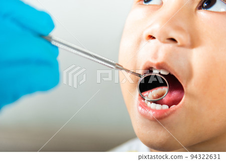 Doctor examines oral cavity of little child uses mouth mirror to checking teeth cavity Doctor examines oral cavity of little child uses mouth mirror to checking teeth cavity 94322631