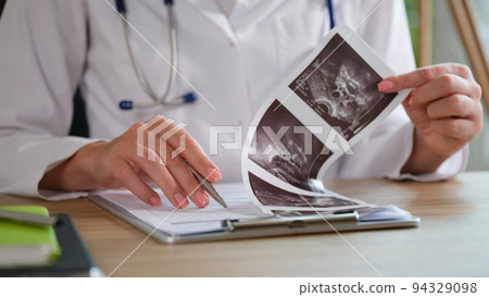 gynecologist examines ultrasound of uterus of patient 94329098