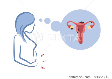 girl with endometriosis and pain womens health anatomy info graphic 94334210
