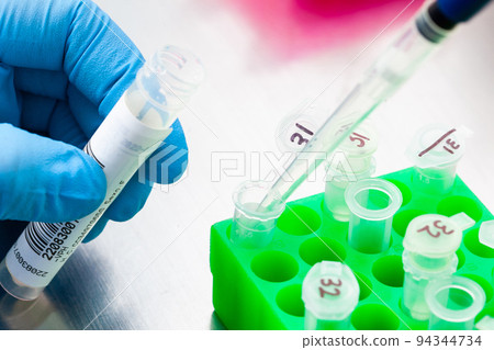 Closeup of a scientist extracting DNA using the spin column-based nucleic acid purification technique. Spin column-based nucleic acid purification technique. Diagnosis of human papillomavirus virus Closeup of a scientist extracting DNA using the spin column-based nucleic acid purification technique. Spin column-based nucleic acid purification technique. Diagnosis of human papillomavirus virus 94344734