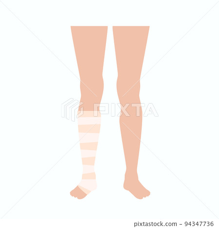 Leg bandage wrapping 94347736