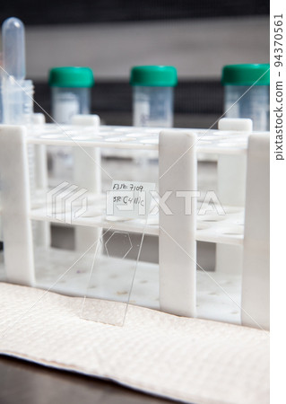 Preparation of slides for karyotipe and fluorescence in situ hybridization - FISH in the laboratory 94370561