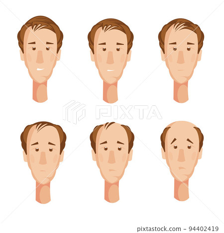 Balding Man Heads Set 94402419