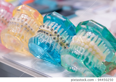 Transparent human jaws with orthodontic braces, metal and ceramic brackets 94450250