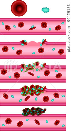 血管凝血機製圖解 94459188