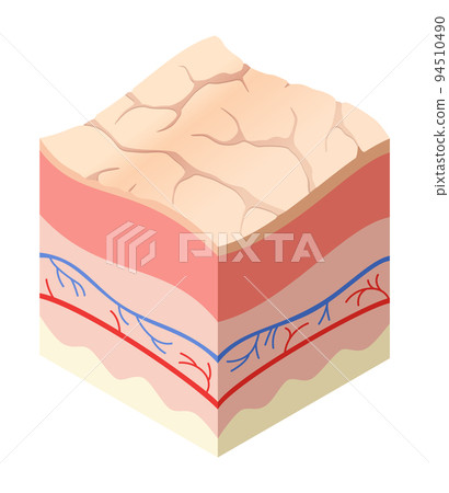 Skincare medical concept. Problems in cross-section of human skin horizontal layers structure. Anatomy illustrative model unhealthly layer of skin Skincare medical concept. Problems in cross-section of human skin horizontal layers structure. Anatomy illustrative model unhealthly layer of skin 94510490