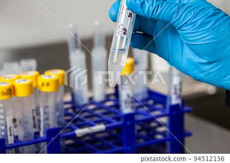 Test tube with blood cells pellet obtained after several washes and centrifugation. 94512136