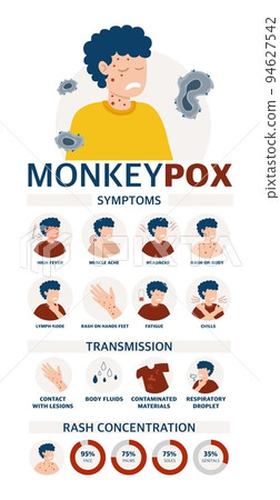 Monkey pox virus Poster to inform about the pandemic and the spread of the disease Images of human methods of spread and symptoms of the disease Vector illustration 94627542