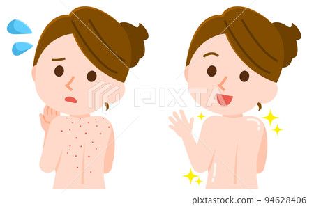 一個患有背部痤瘡的女人一個美麗治癒的女人插圖 94628406