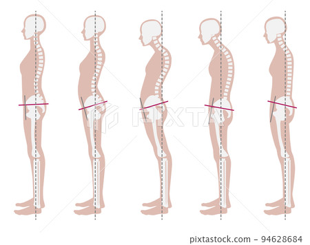 Skeletal sample of good and bad posture 94628684