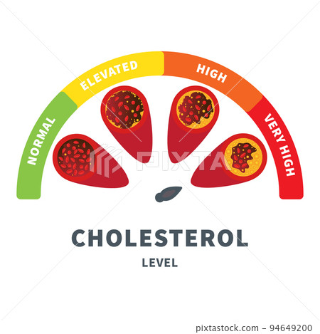 Cholesterol level meter gauge with blood vessel diagram Cholesterol level meter gauge with blood vessel diagram 94649200