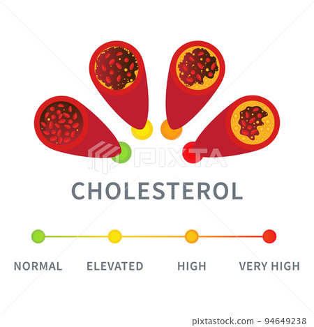 Cholesterol level meter gauge with blood vessel diagram Cholesterol level meter gauge with blood vessel diagram 94649238