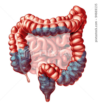 Constipation Anatomy Constipation Anatomy 94669135