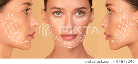 Cosmetology concept. Collage of front and side view portrait of caucasian woman with arrows on face for lifting skin Cosmetology concept. Collage of front and side view portrait of caucasian woman with arrows on face for lifting skin 94672246