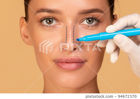 Rhinoplasty concept. Young woman with marking on her nose on beige studio background, closeup 94672370