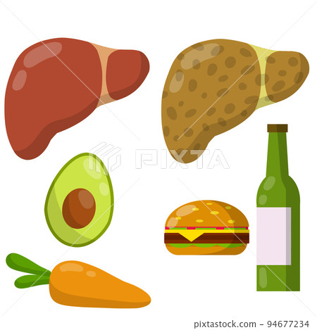 Healthy and diseased liver. 94677234