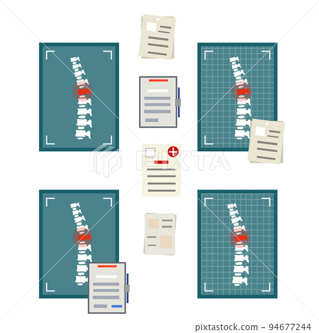 Spine on x-ray image. Bones of back. 94677244