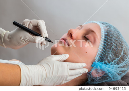 Hands in gloves marking procedure before plastic surgery 94693413