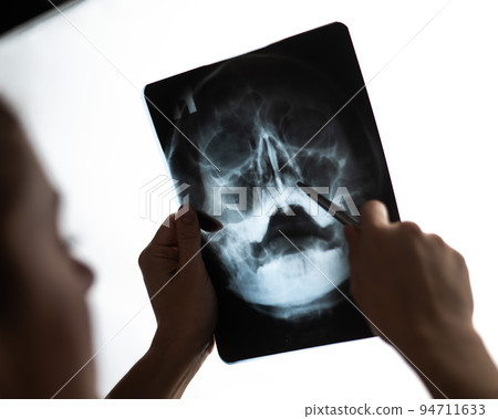 The doctor looks at the x-ray of the sinuses. 94711633