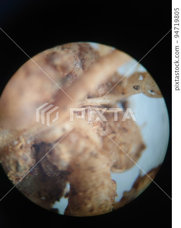 豆科植物的根瘤 94719805