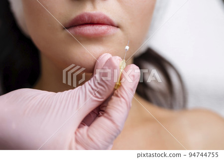 Face lifting PDO Suture operation. innovative technique of New thread lift, cosmetologist preparing to do procedure to female client, select the appropriate thread option Face lifting PDO Suture operation. innovative technique of New thread lift, cosmetologist preparing to do procedure to female client, select the appropriate thread option 94744755