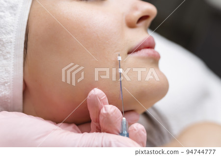 Face lifting PDO Suture operation. innovative technique of New thread lift, cosmetologist preparing to do procedure to female client, select the appropriate thread option Face lifting PDO Suture operation. innovative technique of New thread lift, cosmetologist preparing to do procedure to female client, select the appropriate thread option 94744777