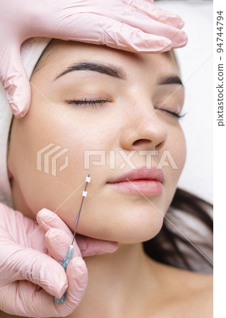Face lifting PDO Suture operation. innovative technique of New thread lift, cosmetologist preparing to do procedure to female client, select the appropriate thread option Face lifting PDO Suture operation. innovative technique of New thread lift, cosmetologist preparing to do procedure to female client, select the appropriate thread option 94744794