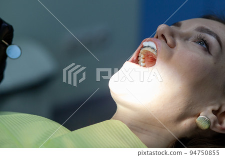 A woman at a dentist's appointment to replace arches with braces A woman at a dentist's appointment to replace arches with braces 94750855