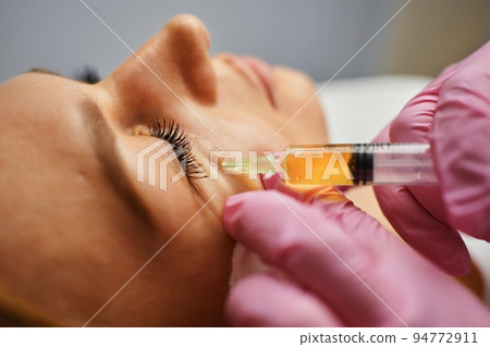 Blood plasma injections in the eye area. 94772911