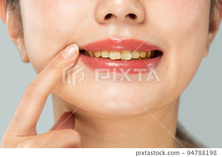女性牙齒變黃 94788198