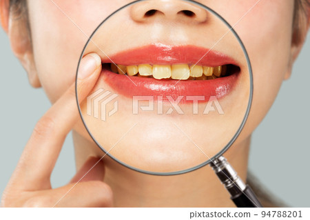 Magnifying a woman's yellowed teeth with a loupe. 94788201