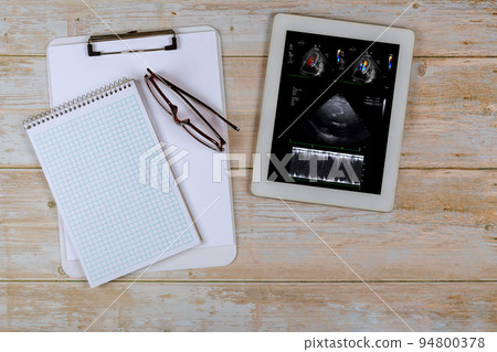 In order to prescribe an effective treatment for the patient, the doctor on the digital tablet reviews the results of the echocardiography ultrasound of the heart examination. 94800378