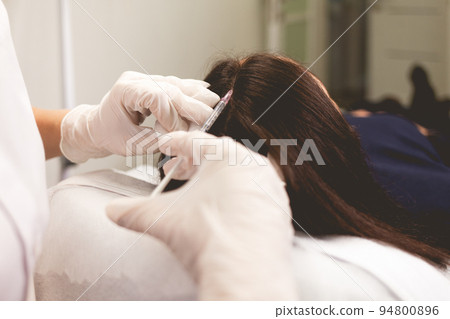 Girl has hair problems. Mesotherapy procedure. Doctor makes an injection against hair loss. 94800896