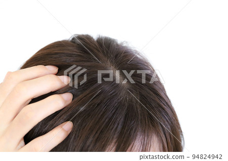 Scalp A woman touching her head 94824942