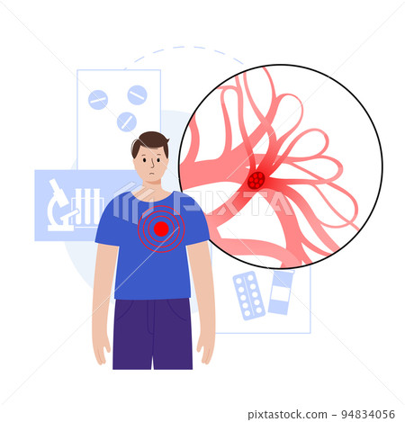 Pulmonary embolism disease Pulmonary embolism disease 94834056