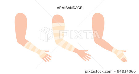 human arm trauma human arm trauma 94834060